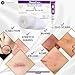 NanaCare Silicone Scar Gel with SPF 20G & Clear Silicone Scar Tape 120