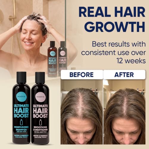 Image of Moerie Ultimate Hair Growth Shampoo & Conditioner Double Set - Longer, Thicker, Fuller Hair - Vegan, Volumizing, Paraben & Silicone Free - Moisturizing for All Hair Types - 4 x 8.45 fl oz (250ml)