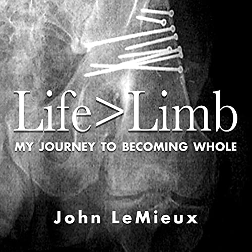 Life Is Greater than Limb by John LeMieux episode artwork