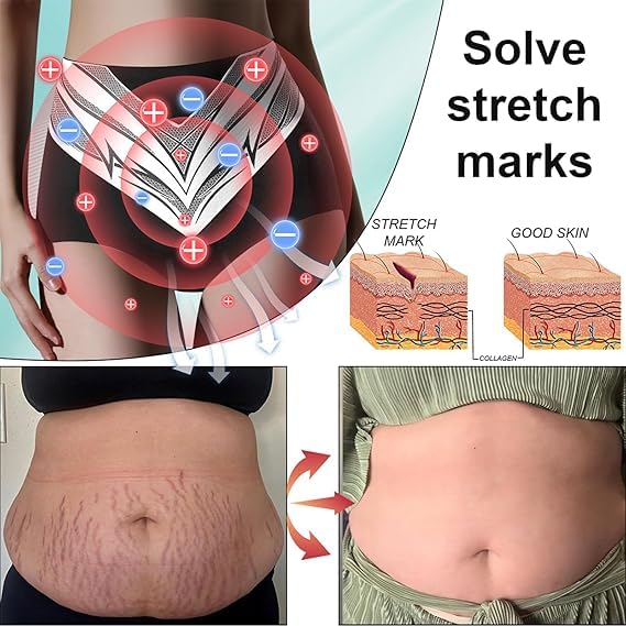 Medical Grade Titanium Fiber Self-Heating Tourmaline Shaping Shorts,2025 New Tummy Control Briefs,Fast & Effectively Shaping3