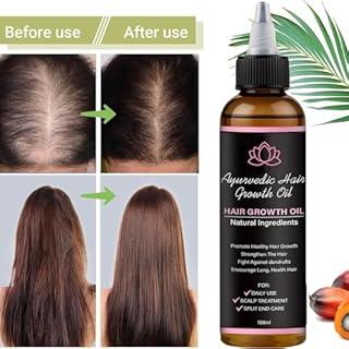 Lifewitqueenp Hair Care Growth Oil, Queenp Ayurvedic Hair Growth Oil, Lightweight for All Hair Types (1pcs)