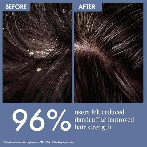 Image of ThriveCo Scalp Clear Shampoo for Dandruff Control | Daily Use Shampoo With Zenscalpin, Hyaplex, Salicylic Acid | For Dandruff, Flaky & Itchy Scalp | For Men & Women 100 ml