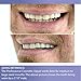Professional Cosmetic Upper - New from Instant Smile! Hand Crafted Detail, Custom fit at Home! Works Best in Medium to Large Sized Mouths.
