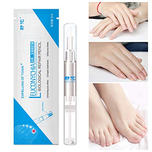 Nvyue 001 Nail Repair Pen-Herbal Nail Treatment Pen,Nail Repair Fingernails Toenails Rich Nutrition(4Pcs) thumb #1