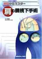 【裁断本】ゼロからマスター 肩の鏡視下手術 メジカルビュー社｜整形外科｜ゼロからマスター 肩の鏡視下手術