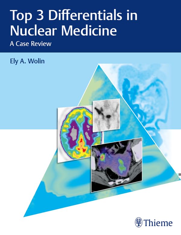 Top 3 Differentials in Nuclear Medicine: A Case Review (English Edition)