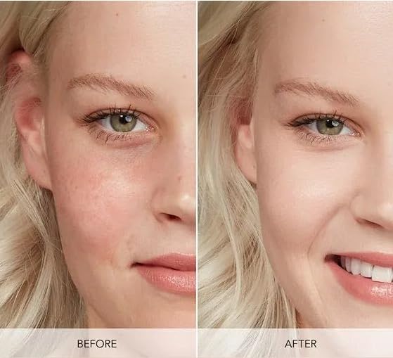 Improved Vitamin C Hyaluronic Acid Retinol Serum Set of 3 (1 Fl Oz each) Brightening, Face Firming, Hydrating Skincare Routine Kit, Anti Wrinkle, Dark Circle Remover Unisex Facial Care Kit - Image 3