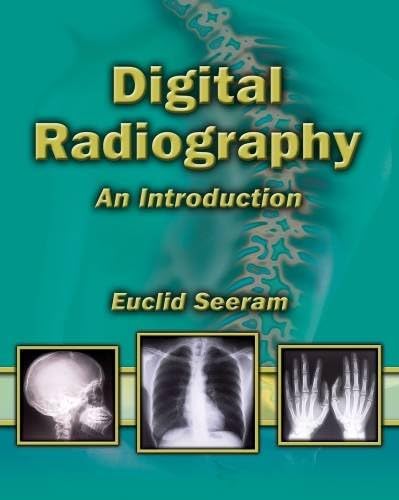 Digital Radiography: An Introduction 1st Edition