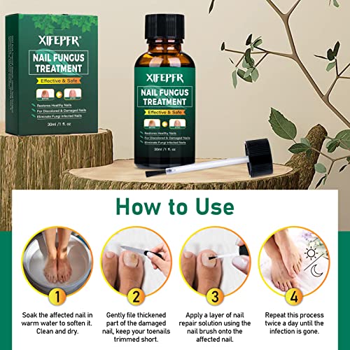 Xifepfr Toenail Repair Treatment Extra Strength, Nail Repair Solution For Toenail And Fingernail, Renewal Liquid For Thick Brittle Damaged Discolored Nails, Restoring Healthy Nails #TOP5