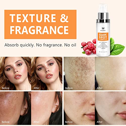 Mesandy MS2208302 Dark Spot Corrector, Dark Spot Remover For Face And Body Serum | Improves Hyperpigmentation, Facial Freckles thumb #2