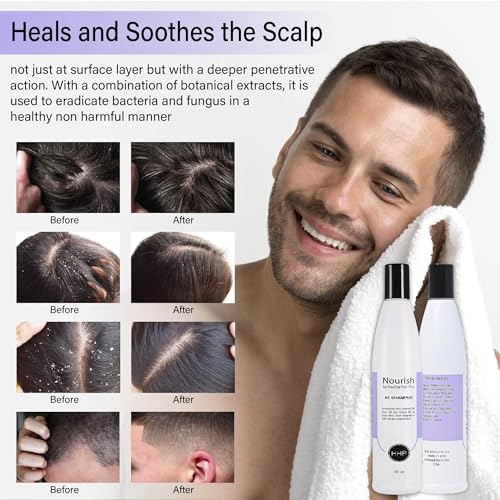Healthy Hair Plus Fungus Shampoo & Conditioner Set By Healthy Hair Plus For Itchy Scalp Relief thumb #2