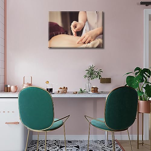 Image of Wall Painting Acupuncture and Moxibustion Paintings for Wall Decorations 1 Panels Physical Therapists do Acupuncture Wall Art Giclee Wooden Framed Gallery-Wrapped Ready to Hang (12 inch Wx18 H)
