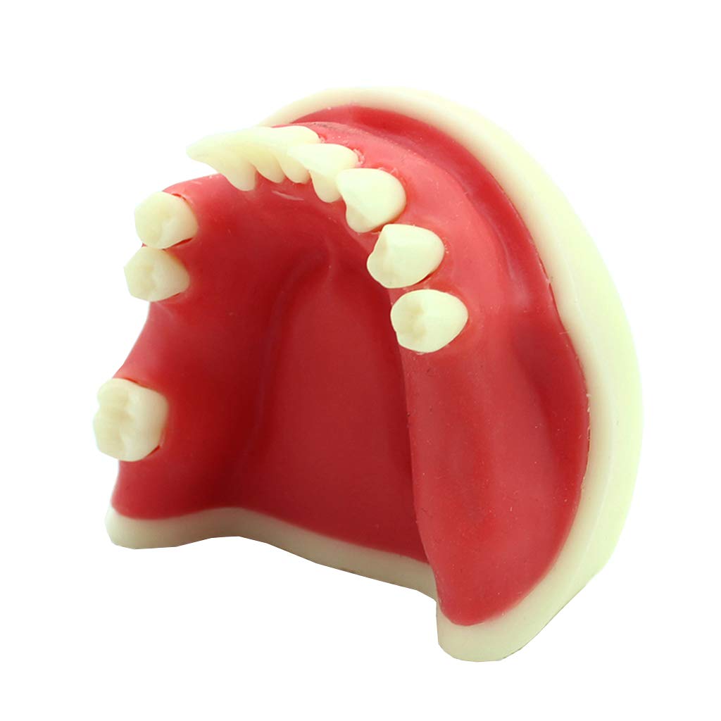 Sjdopulse Adult Mandibular Missing Tooth Model - Dental Teeth Model For Education - Medical Teaching Model Education Teeth Model - For Standard Demonstration Tool