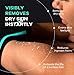 Dermasuri Deep Exfoliating Glove - Polishing Mitt Body Scrubber - Korean Skin Cleaner Exfoliator & Dead Skin Buffing Treatment - Keratosis Pilaris Scrub Remover- Shower Skincare (1 Pack)