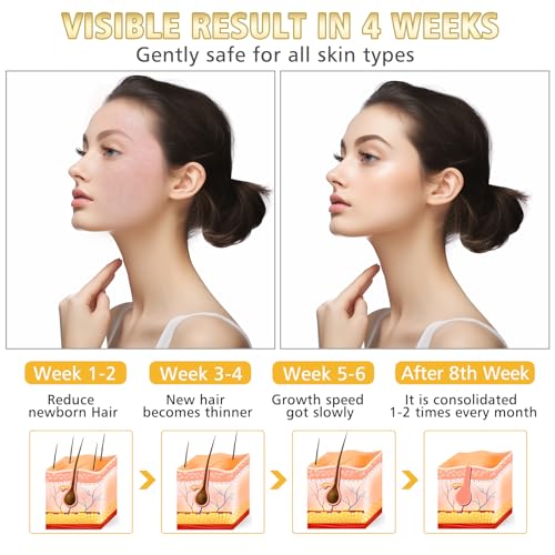 WAYCOM Facial Hair Remover Threading Hair Removal for Women Automatic Threader Machine Epilator for Fine Hairs on Face, Chin, Upper Lip, Arms Birthday Gift,Mother\'s Day Gift - Thumbnail 2