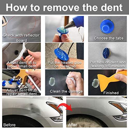 ARISD Auto Paintless Dent Repair Kits - Golden Car Dent Puller with Bridge Dent Puller Kit for Car Hail Damage and Door Dings Repair