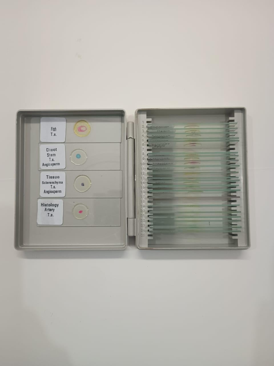 Labgenius Biological Permanent Prepared Microscope Slides – Set of 25 Piece | Includes Animal & Plant Specimens for Biology Students, Schools & Labs-picture-13