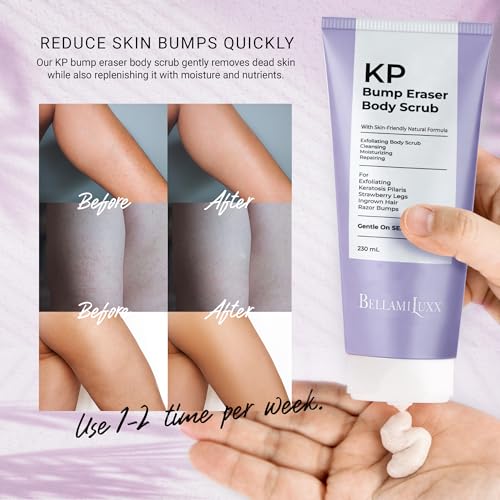 Image of BellamiLuxx KP Bump Eraser Body Scrub: Exfoliating Keratosis Pilaris, Strawberry Skin Treatment - Smooths Rough, Bumpy, Dry Skin on Arms, Legs, Buttocks - KP Scrub Wash Helps Reduce Ingrown Hair Bumps