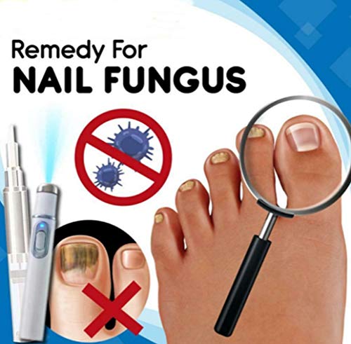 Antischimmelbehandelingsset voor thuis, teennagelbehandelingspen voor snel effect voor nagelschimmel, zoals onychomycose… - Image 6