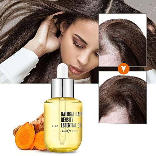 Purc Hair Growth Essential Oil, Natural Hair Density Essential Oil, Purc Oil For Hair Growth, Purc Ginger Hair Growth Oil, Savvy High Hair Growth Fast Growing For Women & Men (3Pc) #TOP7