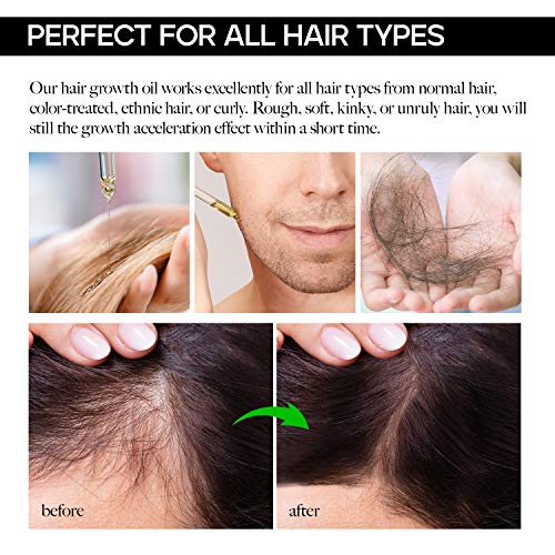 Ginger Hair Growth Serum Ginger Hair Growth Oil for Thicker, Stronger, Longer Hair with Ginger, Biotin, Castor… - Image 5