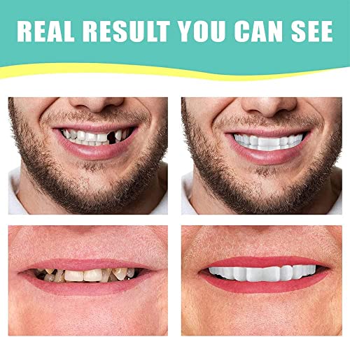 Shxxyljh WX0041 1Set Dentures Veneers Tooth,Dental Care Kits For Anti Molar Orthodontic Cosmetic Teeth,Smile Snap Tooth. thumb #4
