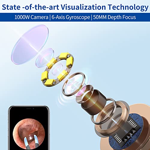 Bebird Pro Note3 Ear Wax Removal Tool Camera, Bebird Ear Cleaner, 10 Megapixel Hd Otoscope With Light, Ear Camera With Tweezers 3-In-1, Spade Ear Cleaner For Iphone, Android（Navy) #TOP3