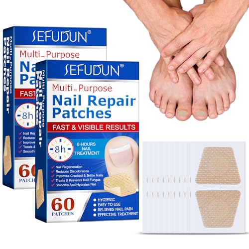 Scettar 120 Piezas Parches Correctores para Uñas de Los Pies Corrector Uñas Encarnadas Parches De Uñas parches de reparación para uñas dañadas y la apariencia de uñas decoloradas