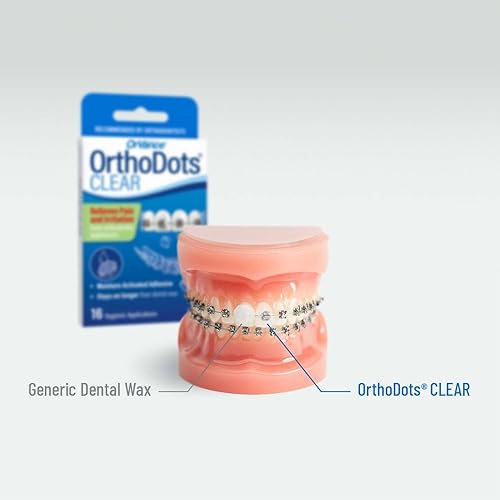 Miniatura 10 de Cera dental OrthoDots transparente, con humedad activada, de silicona, alternativa para el dolor causado por los aparatos de ortodoncia, se adhiere