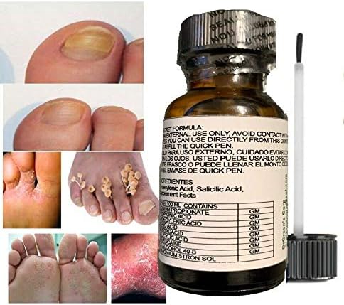Miniatura 6 de Hongos Uñas Tratamiento para Eliminar Onicomicosis y Mantener Uñas Saludables