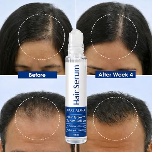 Image of Rosemary Hair Growth Serum (Roll On) | Boosts Hair Density, Stimulates Growth & Reduces Hair Fall | Enriched with Rice Water | For Women & Men (30ml - Roll On)