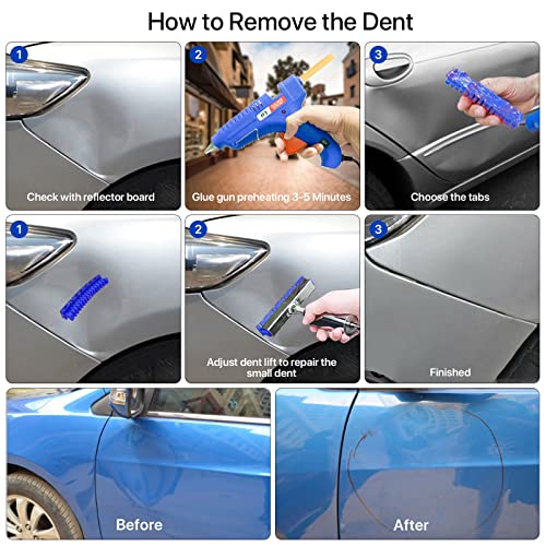 Zeusfire Dent Puller Kit, 97 Pcs Paintless Dent Removal Kit With Double Pole Bridge Puller, Slide Hammer T-Bar Dent Puller, Golden Lifter, Suction Cup, And Glue Gun For Car Dent Repair #TOP5