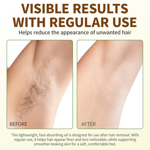 Image of Uocasi Cyperus Rotundus Oil, Cypress Rotundus Oil for Hair Removal, Natural Inhibitor to Reduce Unwanted Hair Growth, Soothes Skin & Minimizes Pores, All Skin Types, 2.02 Oz