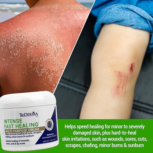 TriDerma Intense Fast Healing Cream, Decreases Healing Time for Minor Irritations, Rashes, Scrapes, Cuts 4 Ounces