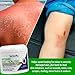 TriDerma Intense Fast Healing Cream, Decreases Healing Time for Minor Irritations, Rashes, Scrapes, Cuts 4 Ounces