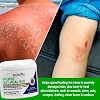 TriDerma Intense Fast Healing Cream, Decreases Healing Time for Minor Irritations, Rashes, Scrapes, Cuts 4 Ounces
