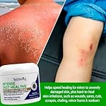 TriDerma Intense Fast Healing Cream, Decreases Healing Time for Minor Irritations, Rashes, Scrapes, Cuts 4 Ounces - Image 2