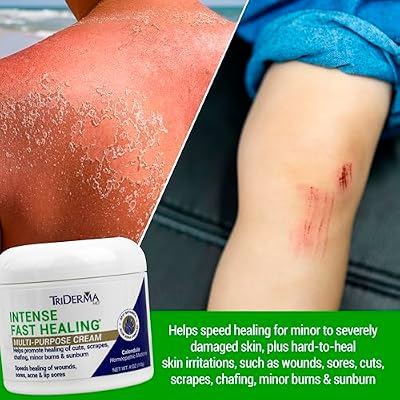 TriDerma Intense Fast Healing Cream, Decreases Healing Time for Minor Irritations, Rashes, Scrapes, Cuts 4 Ounces