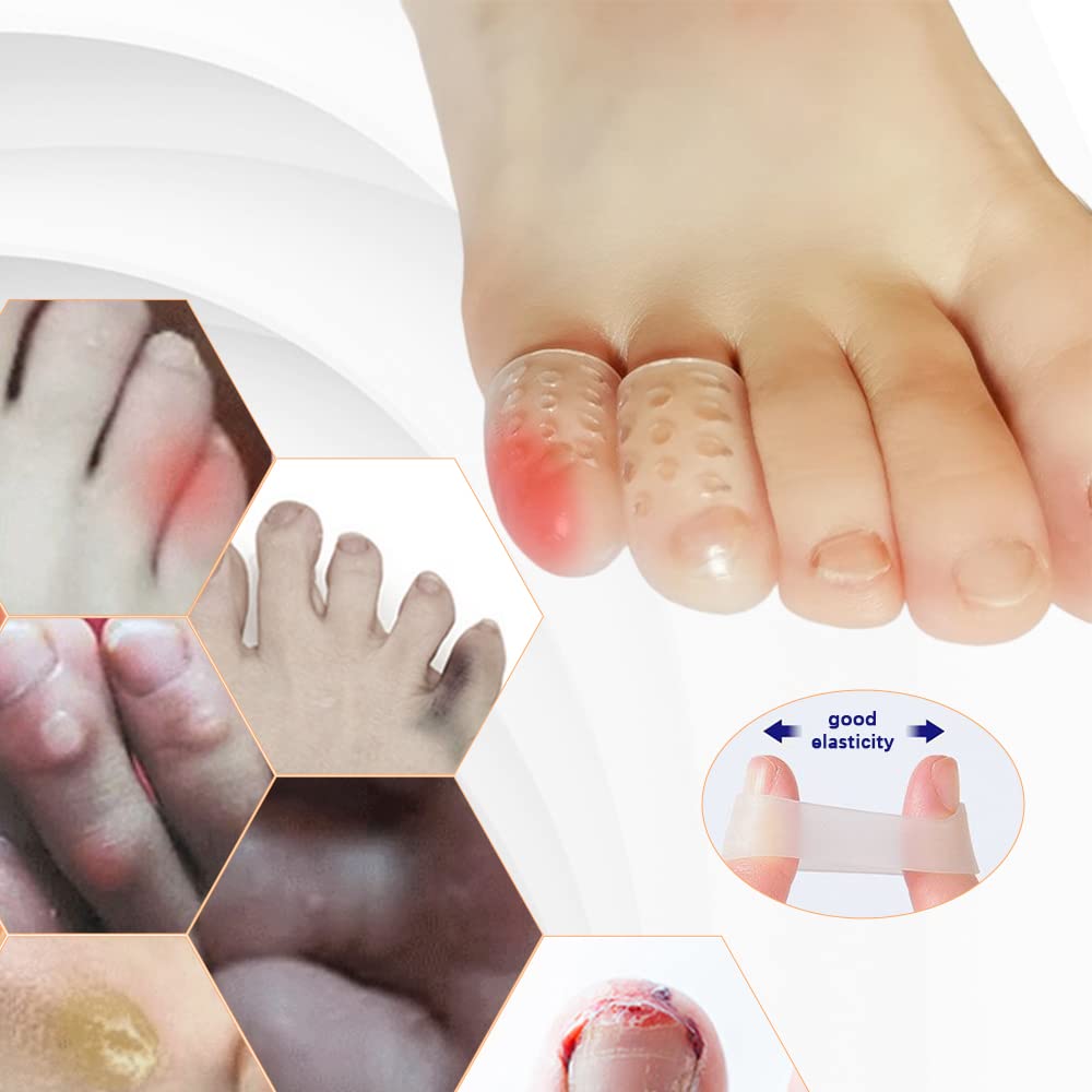 100 protezioni per dita in silicone anti-attrito, traspiranti, in gel, per uomini e donne, sollievo dal dolore da calli, vesciche, graffi