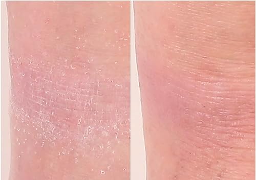 Miniatura 4 de Nakery Tratamiento de reparación intensiva para aliviar el eccema crema calmante para rostro y cuerpo | 2% de avena coloidal | Alivio inmediato