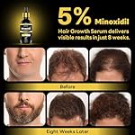 5% Minoxidil with Rosemary and Biotin for Men and Women Hair Growth,Beard Growth Kit,Scalp Serum for Thicker Fuller Hair - Image 4
