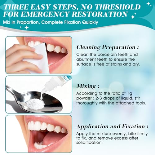 SHOPPGO Zahnkleber für Kronen, Zahnfüllung Selbsthärtend Dauerhaft für Karies, Zahnzement Selbsthärtend Dauerhaft, Verlorene Füllungen, Brücken, Kronen, Füllungen, Schnelltrocknend, 4 Stück