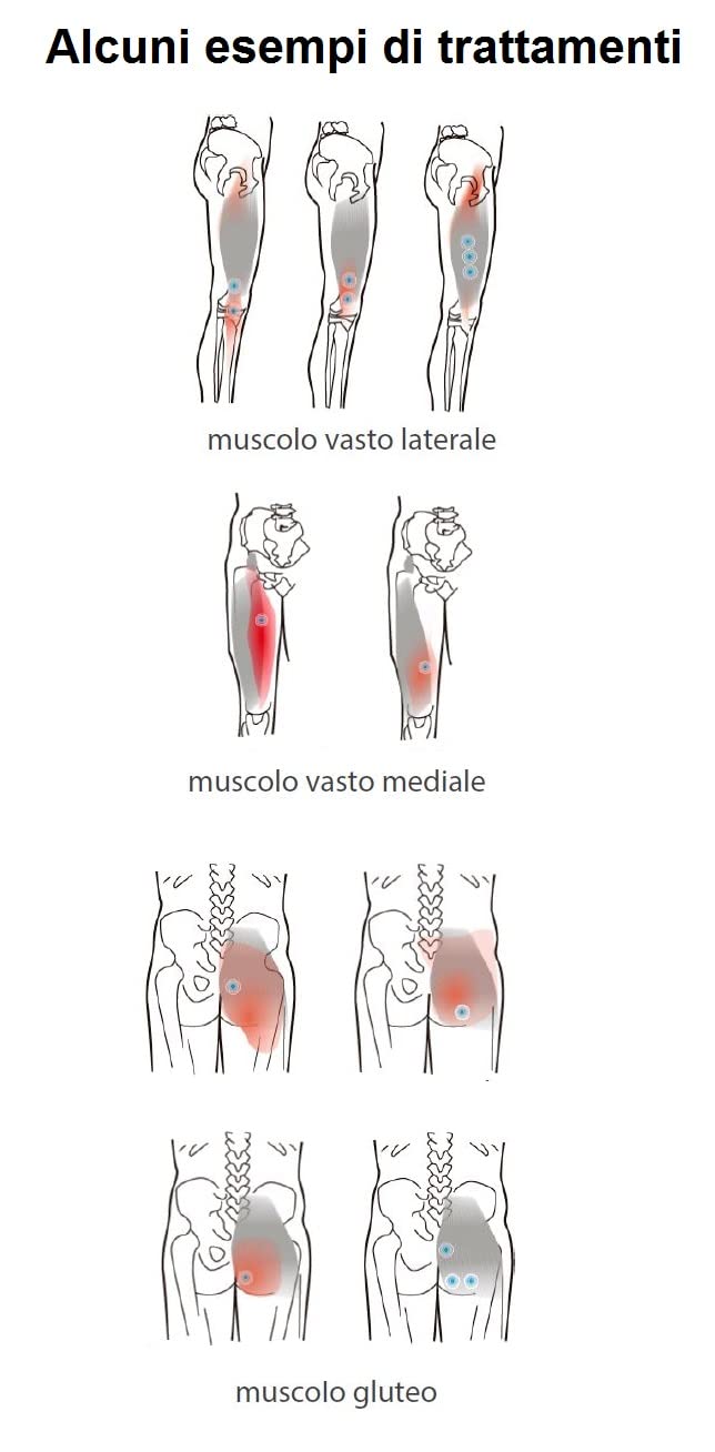 Ultrasuoni portatile terapie antidolorifiche massaggi con ultrasuonoterapia per il benessere di tutto il corpo con gel Arnica