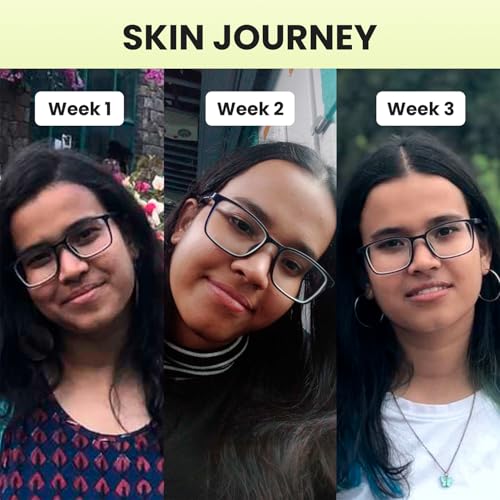 Cos-IQ 20% Niacinamide Face Serum For Clear Glowing Skin, Bright Skin, Reduces Dullness, Hydrates & Repairs Skin with Vit B3 & Hyaluronic Acid for Targets Acne Marks | For Women... - Image 5