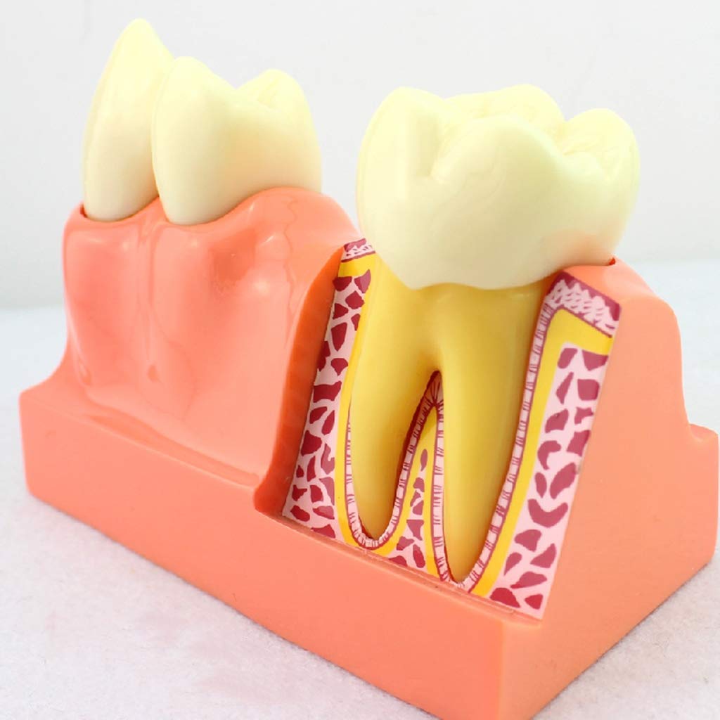 Modello di Anatomia per L'Insegnamento in Odontoiatria Modello Didattico per Lo Studio dei Denti Modello di Denti con Ingrandimento 4X Modello di Denti Dimostra