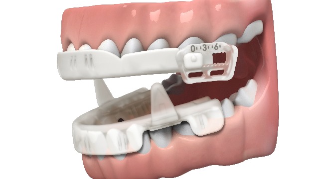 Amazon.com: SleepRight Snore Aid – FDA Cleared for Snoring – Anti