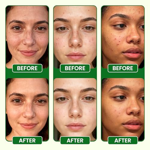 Lukaree Vitamin C Serum for Face – Brightening Vitamina C Facial Serum with Sodium Hyaluronate | Evens Skin Tone & Smooths Fine Lines | Antioxidant-Rich Beauty Product for All Skin Types,1 Fl Oz — view 5