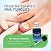 Amada Pure Toenail Fungus Treatment (30 ml)