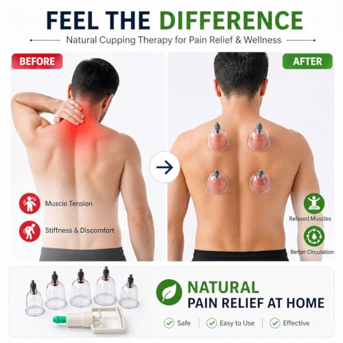 Image of Vacuum Cupping Therapy Set - DVESH Cupping Kit for Pain Relief, Muscle Recovery, Body Massage & Blood Circulation - Portable Manual Therapy Cups with Magnetic Heads, Transparent Design (Pack of -10 ,ONLY CUPPING) - SIZE 1