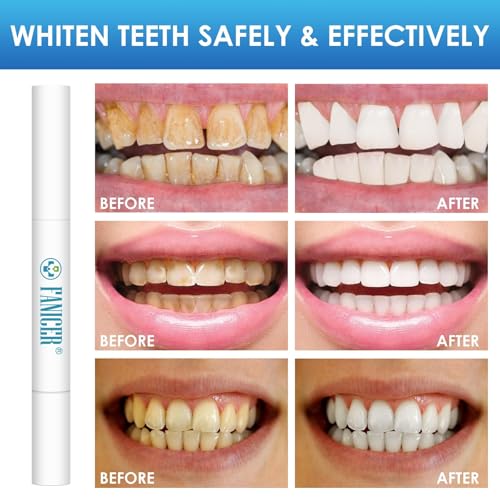 2 Stück Zahnaufhellungs-Stifte, Teeth Whitening Pen, Tragbar Aufhellungspen Weiße Zähne, Einfach zu Verwenden, Effektiv Flecken Entfernen Weiße Zähne, für strahlendes Lächeln